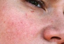 ¿Reconocimiento de venas? ¡Apple nos sorprenderá! Venas en Iphone