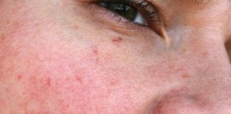 ¿Reconocimiento de venas? ¡Apple nos sorprenderá! Venas en Iphone