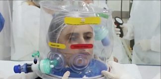 Este casco de respiración artificial reduce enormemente la intubación por covid-19 casco